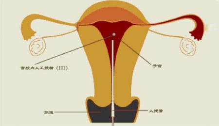 黑客24小时在线接单网站